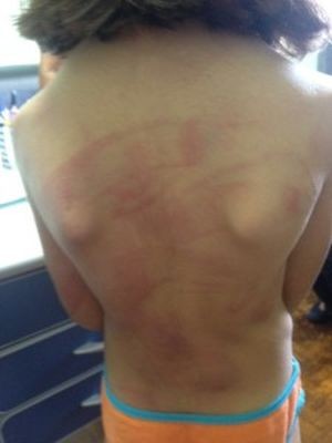 Menina ficou com marcas da agressão (Foto: Divulgação/Polícia Civil)
