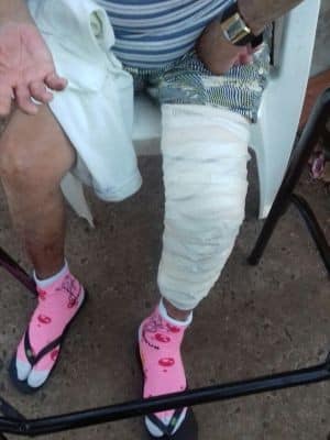 Na quinta-feira (25), Maria Ivone voltou à Santa Casa para novo procedimento (Foto: Francisco Fernando Leme/Arquivo Pessoal)