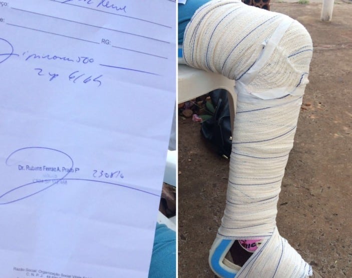 Idosa passou por vários atendimentos médicos até ser enfaixada (Foto: Diego Santos/ Bariri Rádio Clube )