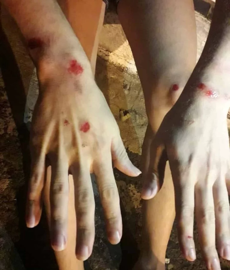 Jovem registra BO após ser agredido por grupo em Tupã; ele alega homofobia — Foto: Arquivo pessoal