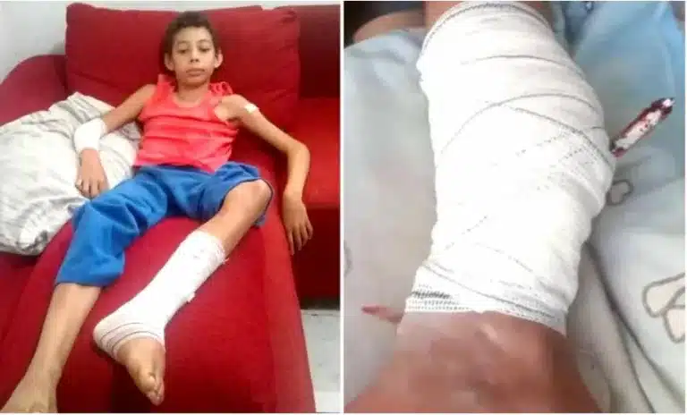 Vinícius Gustavo de Oliveira, de 11 anos, em recuperação após ficar com uma barra de ferra cravada na perna: "Tive medo" - Foto: Arquivo pessoal