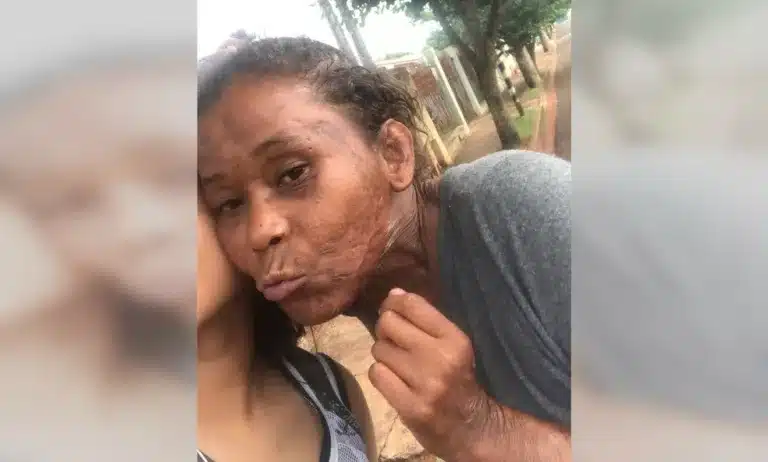 Juliana da Silva Rosa, de 31 anos, foi atacada por três pitbulls que teriam escapados por um portão aberto em Ourinhos — Foto: Arquivo pessoal